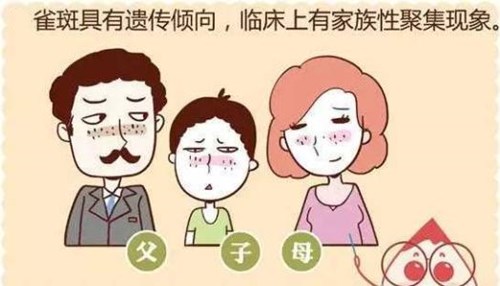 雀斑遗传