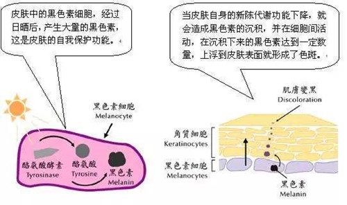 黑色素