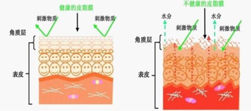 角质层