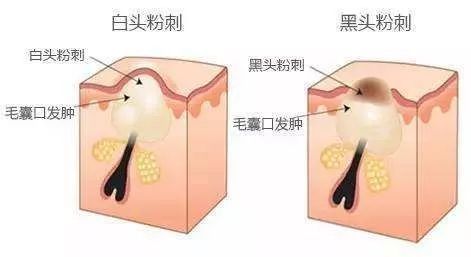 油脂分泌