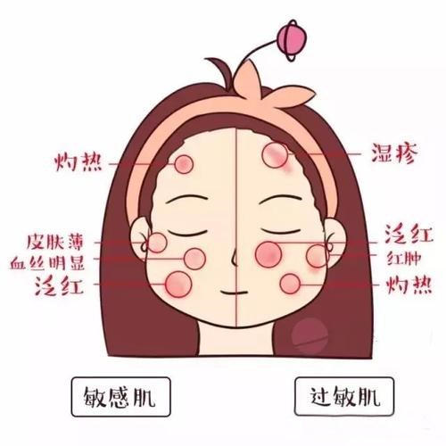 敏感肌