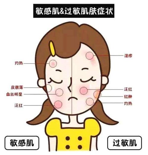 敏感与过敏区别