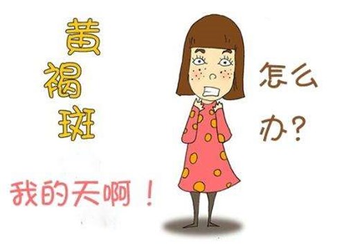 黄褐斑