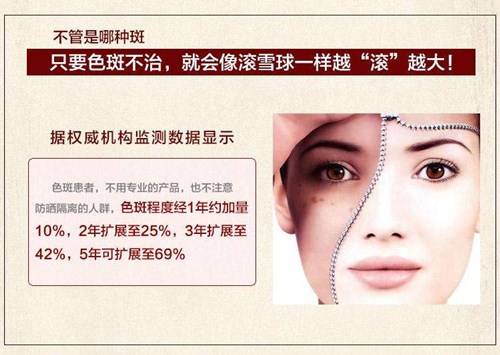 黄褐斑要提早治疗