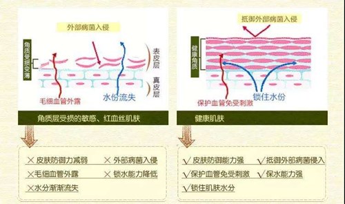 健康肌肤与受损肌肤