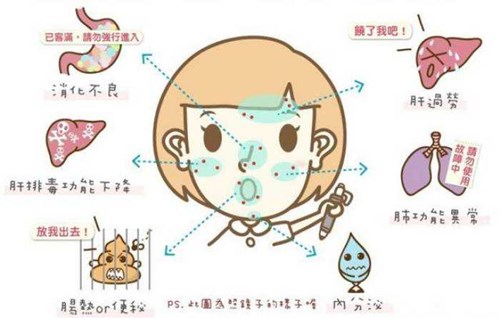 长痘原因