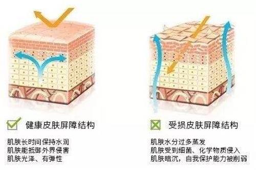 皮肤屏障
