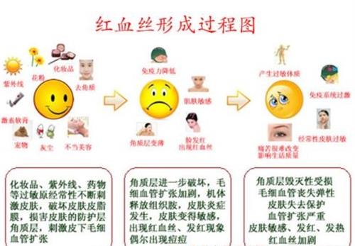 红血丝形成过程
