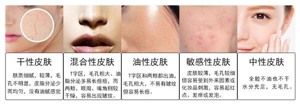肌肤类型