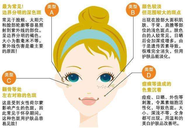 色斑分布