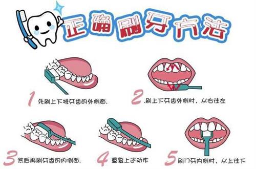 正确刷牙