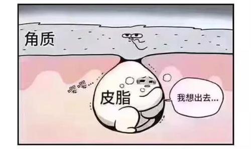 痘痘形成原理