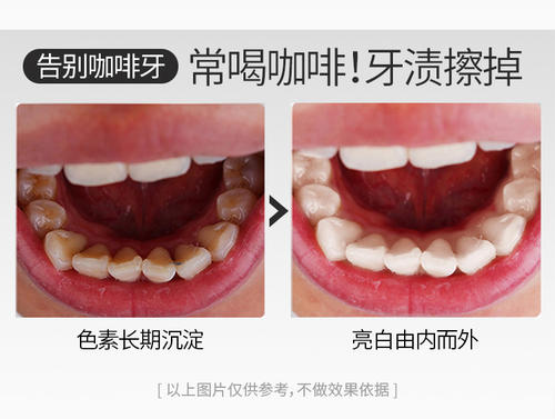 牙黄