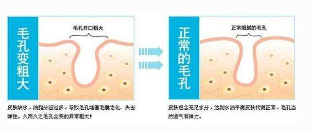 油脂分泌