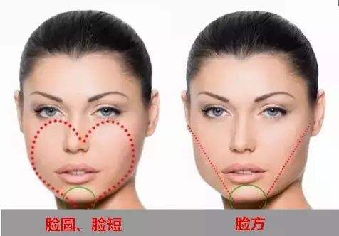 打完瘦脸针要注意