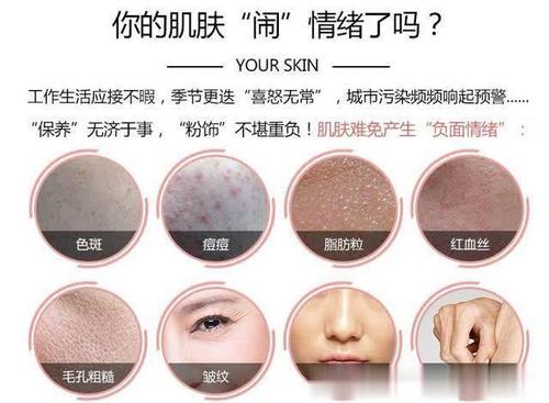 皮肤管理重要性