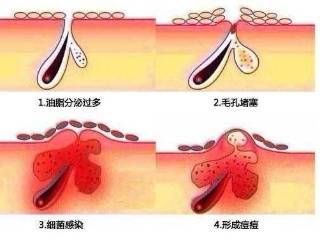油脂分泌