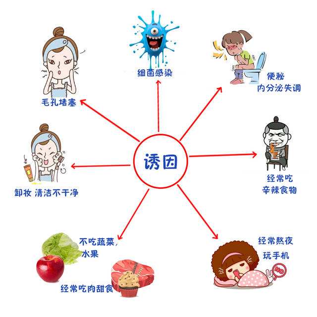 痘痘产生诱因