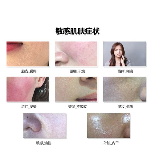 敏感肌困扰