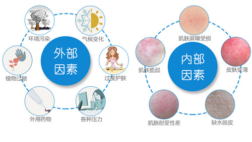 肌肤敏感原因