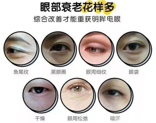 眼部衰老趋势