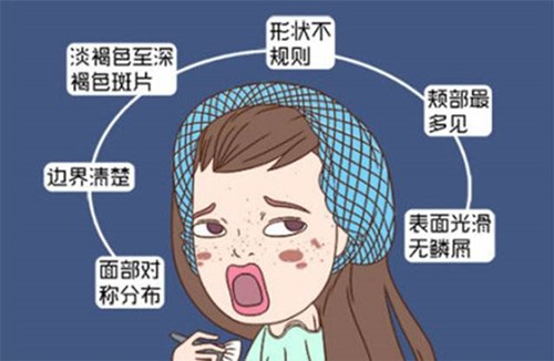 黄褐斑