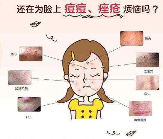痘痘