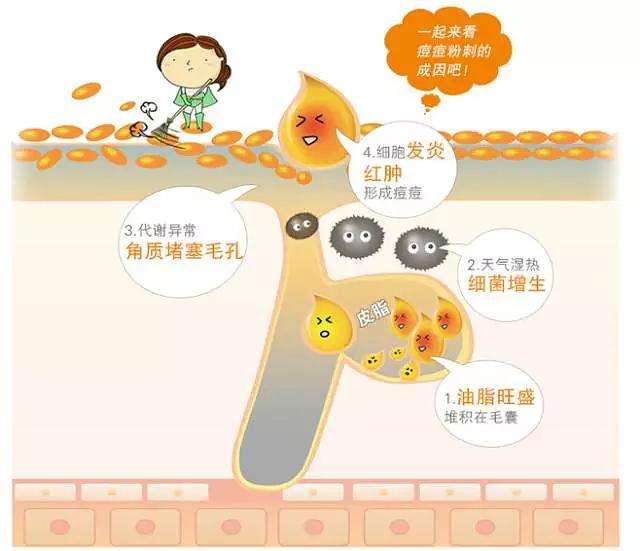 痘痘形成