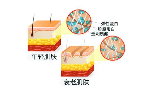 抗衰