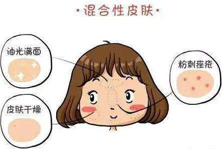 混合型肌肤