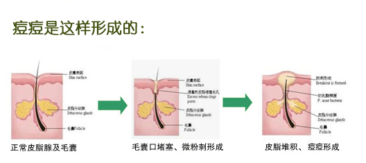 痘痘