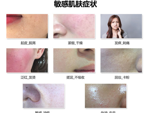 敏感肌症状