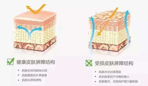肌肤屏障受损