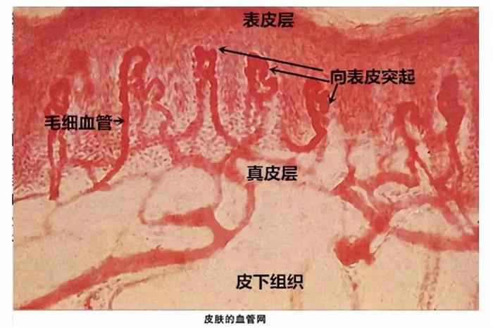 毛细血管突出造成红血丝