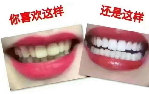 你想拥有一口好牙还是想拥有黄黄的牙齿