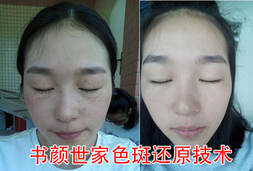 色斑还原技术效果对比