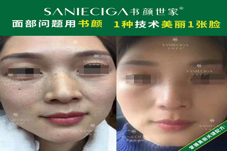书颜世家祛斑产品加盟费用贵不贵