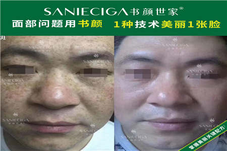 现下杭州加盟皮肤管理要多少钱