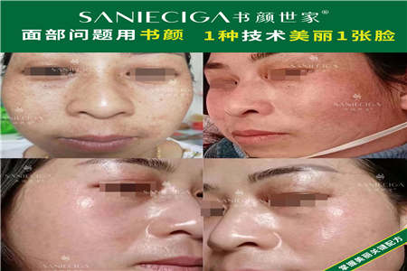 杭州皮肤管理加盟多少钱 
