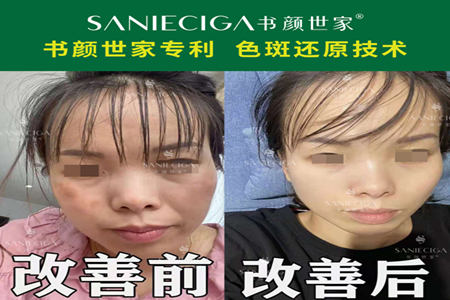2021杭州管理皮肤加盟哪家好
